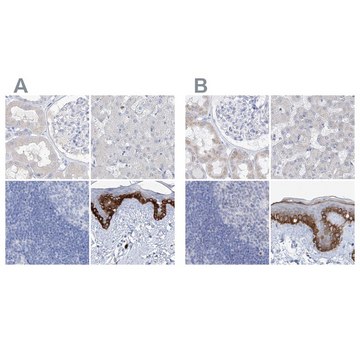 Anti-FRS3 antibody produced in rabbit Prestige Antibodies&#174; Powered by Atlas Antibodies, affinity isolated antibody, buffered aqueous glycerol solution, ab2