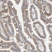 Anti-TMIGD2 antibody produced in rabbit Prestige Antibodies® Powered by Atlas Antibodies, affinity isolated antibody, buffered aqueous glycerol solution