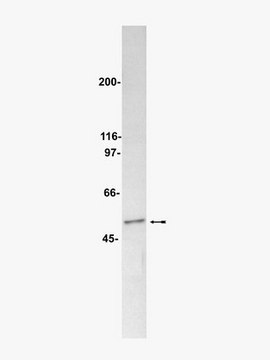 抗-PP2A抗体，B亚基，克隆2G9 ascites fluid, clone 2G9, Upstate&#174;