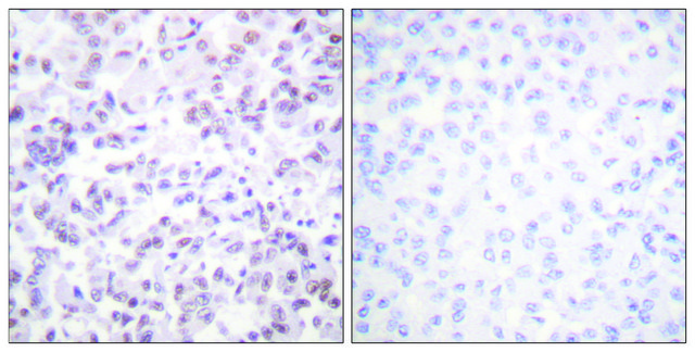 Anti-Histone H2B antibody produced in rabbit affinity isolated antibody