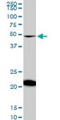 Monoclonal Anti-NADK antibody produced in mouse clone 5F4, purified immunoglobulin, buffered aqueous solution