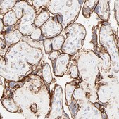 Anti-ITGA5 antibody produced in rabbit Prestige Antibodies&#174; Powered by Atlas Antibodies, affinity isolated antibody, buffered aqueous glycerol solution