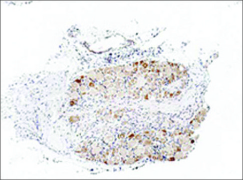 抗-TRPA1 兔抗 affinity isolated antibody