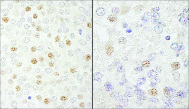 Rabbit anti-CDC20 Antibody, Affinity Purified Powered by Bethyl Laboratories, Inc.