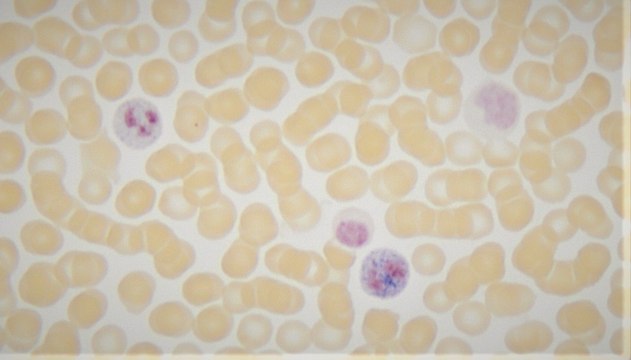 Leukocyte Alkaline Phosphatase Kit based on naphthol AS-MX phosphate and fast blue RR salt (with citrate)