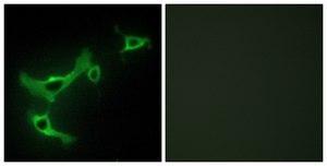 Anti-TRIM3 antibody produced in rabbit affinity isolated antibody