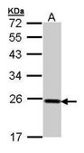 Anti-GPX2 antibody produced in rabbit affinity isolated antibody, buffered aqueous solution