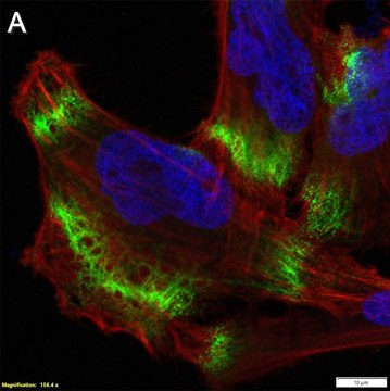 Anti-MCT1/SLC16A1 Antibody, clone 2B21 ZooMAb&#174; Rabbit Monoclonal recombinant, expressed in HEK 293 cells