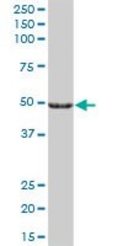 Anti-CYP27A1 antibody produced in mouse IgG fraction of antiserum, buffered aqueous solution