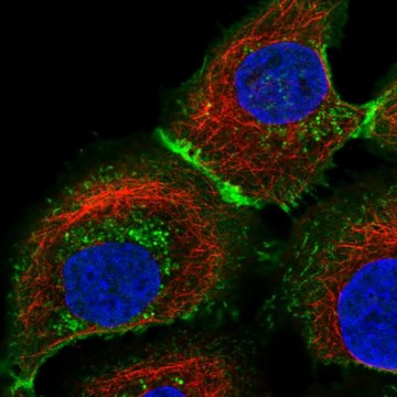 Anti-SLC16A1 antibody produced in rabbit affinity isolated antibody