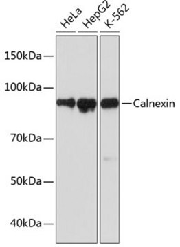 Anti-Calnexin Antibody, clone 5S3U3, Rabbit Monoclonal