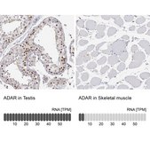 Anti-ADAR antibody produced in rabbit Prestige Antibodies® Powered by Atlas Antibodies, affinity isolated antibody, buffered aqueous glycerol solution