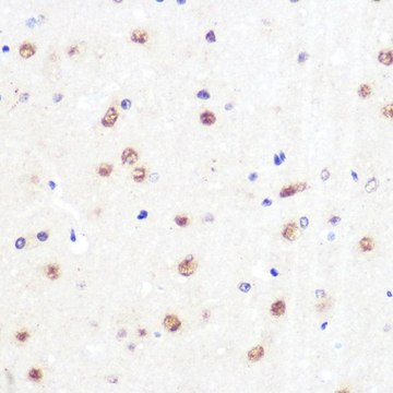 Anti-KLF4 antibody produced in rabbit