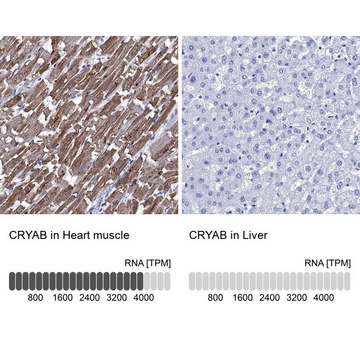 Anti-CRYAB antibody produced in rabbit Prestige Antibodies&#174; Powered by Atlas Antibodies, affinity isolated antibody, buffered aqueous glycerol solution