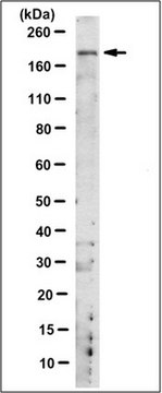 Anti-CRB1 Antibody, clone 1C2.1 clone 1C2.1, from mouse