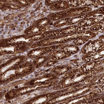 Anti-CARD19 antibody produced in rabbit Prestige Antibodies&#174; Powered by Atlas Antibodies, affinity isolated antibody, buffered aqueous glycerol solution