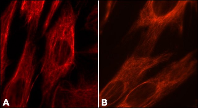 Anti-Vimentin antibody, Mouse monoclonal clone LN-6, purified from hybridoma cell culture