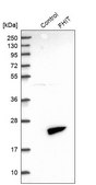 Anti-FHIT antibody produced in rabbit Prestige Antibodies® Powered by Atlas Antibodies, affinity isolated antibody, buffered aqueous glycerol solution