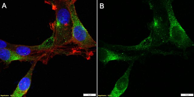 Anti-GPR158 Antibody, clone 2D19 ZooMAb&#174; Rabbit Monoclonal recombinant, expressed in HEK 293 cells