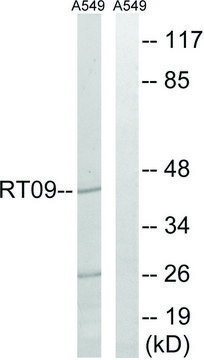 Anti-MRPS9 antibody produced in rabbit affinity isolated antibody