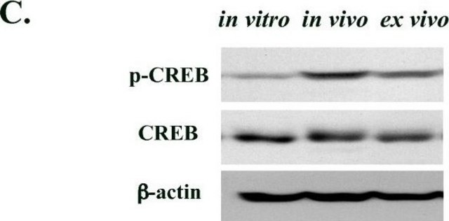 抗磷酸化-CREB (Ser133) 抗体 Upstate&#174;, from rabbit