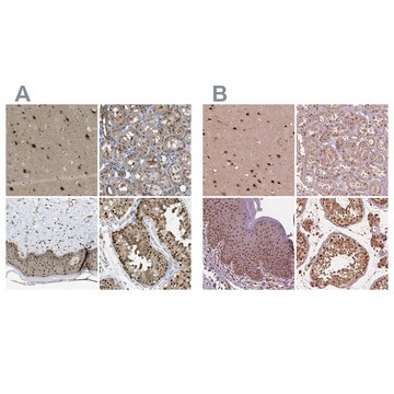 Anti-PSMC5 antibody produced in rabbit Prestige Antibodies&#174; Powered by Atlas Antibodies, affinity isolated antibody, buffered aqueous glycerol solution