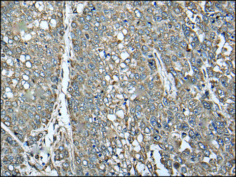 Anti-ATAD1 affinity isolated antibody