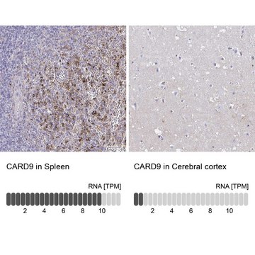 Anti-CARD9 antibody produced in rabbit Prestige Antibodies&#174; Powered by Atlas Antibodies, affinity isolated antibody, buffered aqueous glycerol solution