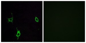 Anti-LAMC3 antibody produced in rabbit affinity isolated antibody