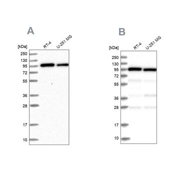 Anti-COPG1 antibody produced in rabbit Prestige Antibodies&#174; Powered by Atlas Antibodies, affinity isolated antibody, buffered aqueous glycerol solution