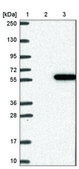 Anti-CCDC78 antibody produced in rabbit Prestige Antibodies® Powered by Atlas Antibodies, affinity isolated antibody, buffered aqueous glycerol solution