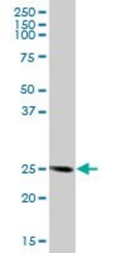 Anti-FKBP14 antibody produced in mouse purified immunoglobulin, buffered aqueous solution