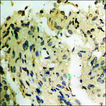 Anti-phospho-ZAP-70 (pTyr493) antibody produced in rabbit affinity isolated antibody