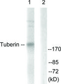 Anti-TSC2 antibody produced in rabbit affinity isolated antibody