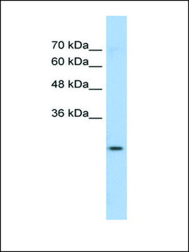 Anti-GSTM1 antibody produced in rabbit affinity isolated antibody