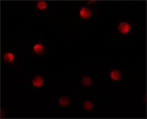 Anti-N4BP1 antibody produced in rabbit affinity isolated antibody