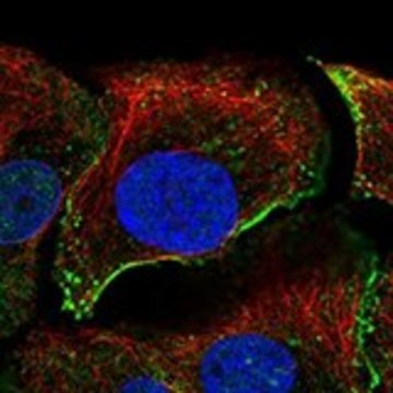 Anti-DAG1 antibody produced in rabbit Prestige Antibodies&#174; Powered by Atlas Antibodies, affinity isolated antibody, buffered aqueous glycerol solution