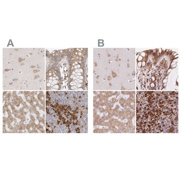 Anti-RPN1 antibody produced in rabbit Prestige Antibodies&#174; Powered by Atlas Antibodies, affinity isolated antibody, buffered aqueous glycerol solution