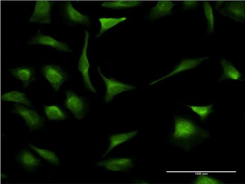 Monoclonal Anti-XBP1 antibody produced in mouse clone 3F5, purified immunoglobulin, buffered aqueous solution