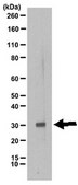 Anti-TIGAR Antibody from rabbit, purified by affinity chromatography