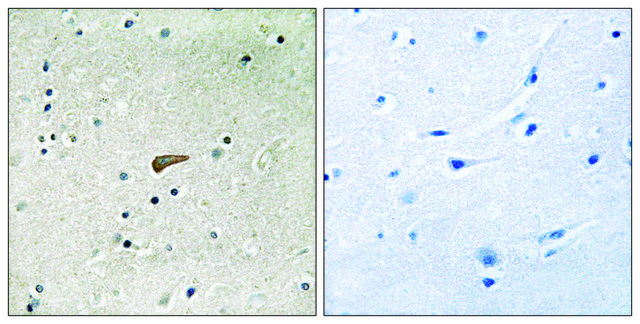 Anti-phospho-FRS2 (pTyr436) antibody produced in rabbit affinity isolated antibody