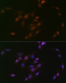 Anti-p38 MAPK Antibody, clone 2H9Q5, Rabbit Monoclonal