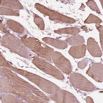 Anti-NMRK2 antibody produced in rabbit Prestige Antibodies&#174; Powered by Atlas Antibodies, affinity isolated antibody