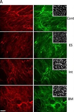 Anti-Collagen Type VI Antibody, clone 3C4 ascites fluid, clone 3C4, Chemicon&#174;