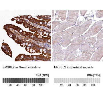 Anti-EPS8L2 antibody produced in rabbit Prestige Antibodies&#174; Powered by Atlas Antibodies, affinity isolated antibody, buffered aqueous glycerol solution