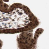 Anti-GALT antibody produced in rabbit Ab1, Prestige Antibodies® Powered by Atlas Antibodies, affinity isolated antibody, buffered aqueous glycerol solution