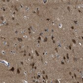 Anti-NUDCD3 antibody produced in rabbit Prestige Antibodies® Powered by Atlas Antibodies, affinity isolated antibody, buffered aqueous glycerol solution, Ab3