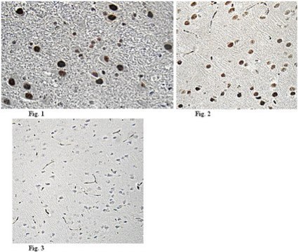 抗Bcl-2相关转录因子1抗体 from rabbit, purified by affinity chromatography