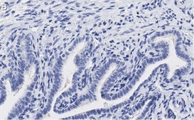 Anti-PKCι Antibody, clone 1J13 ZooMAb® Rabbit Monoclonal recombinant, expressed in HEK 293 cells