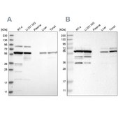 Anti-CCT8 antibody produced in rabbit Prestige Antibodies® Powered by Atlas Antibodies, affinity isolated antibody, buffered aqueous glycerol solution